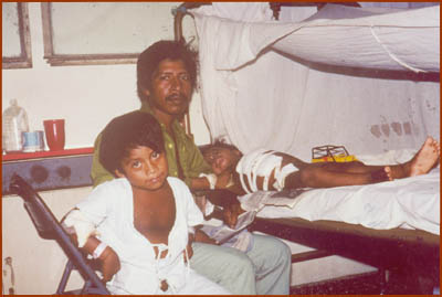 Land mine victims in Children's Hospital, Managua